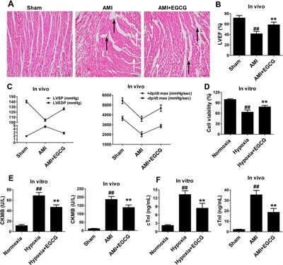 Exosomes Derived From Epigallocatechin Gallate-Treated Cardiomyocytes Attenuated Acute Myocardial Infarction by Modulating MicroRNA-30a